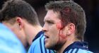 Dublin’s Conal Keaney sporting a head injury after last weekend’s Allianz Hurling League victory over Kilkenny at Nowlan Park.  Photo: Cathal Noonan/Inpho