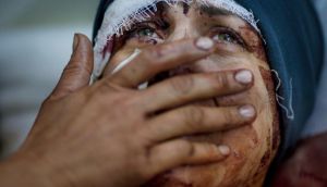 Aida cries as she recovers from severe injuries sustained during a Syrian military bombardment of her home, in the northern city of Idlib. Her husband and two children were killed in the attack. Photograph: Rodrigo Abd/AP