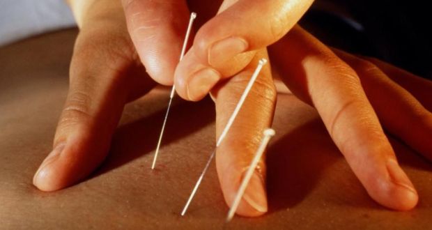 Understanding Acupuncture Through Eastern And Western - 
