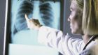 There are five radiologists per 100,000 population in Ireland compared with 7.8 in Germany and 11.3 in France, says Royal College of Surgeons. 