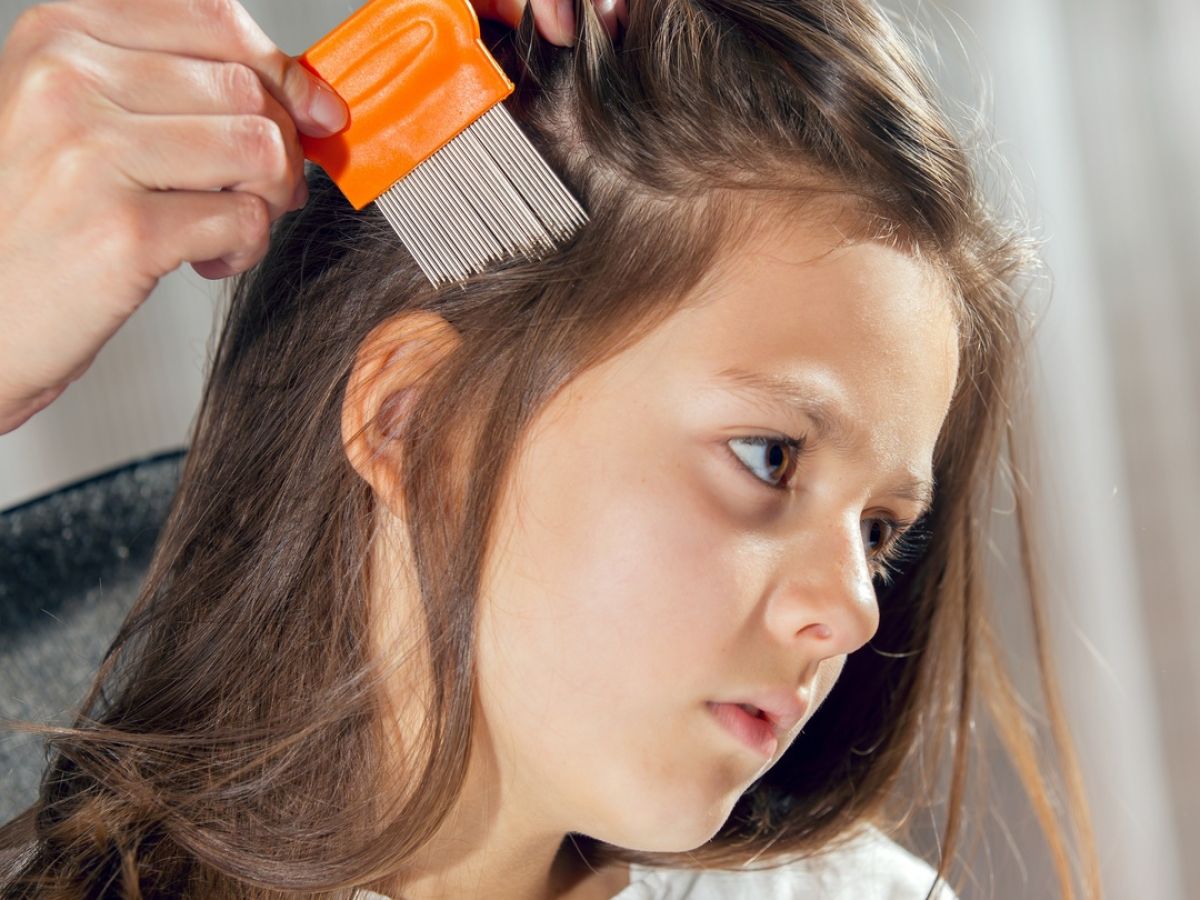 What Is The Best Way To Tackle Head Lice