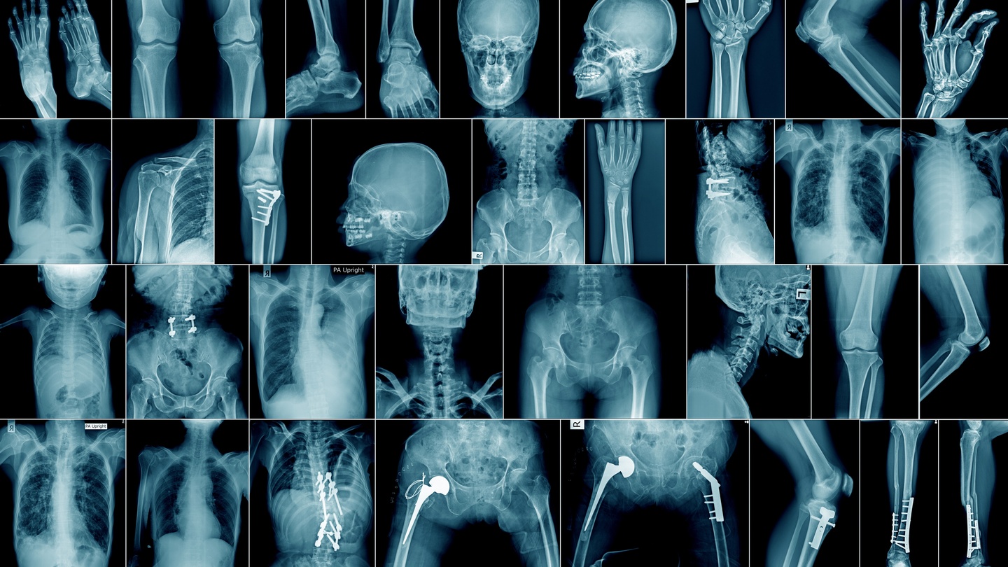 Aanvankelijk baden Harmonisch Are X-rays overused in Irish hospitals?