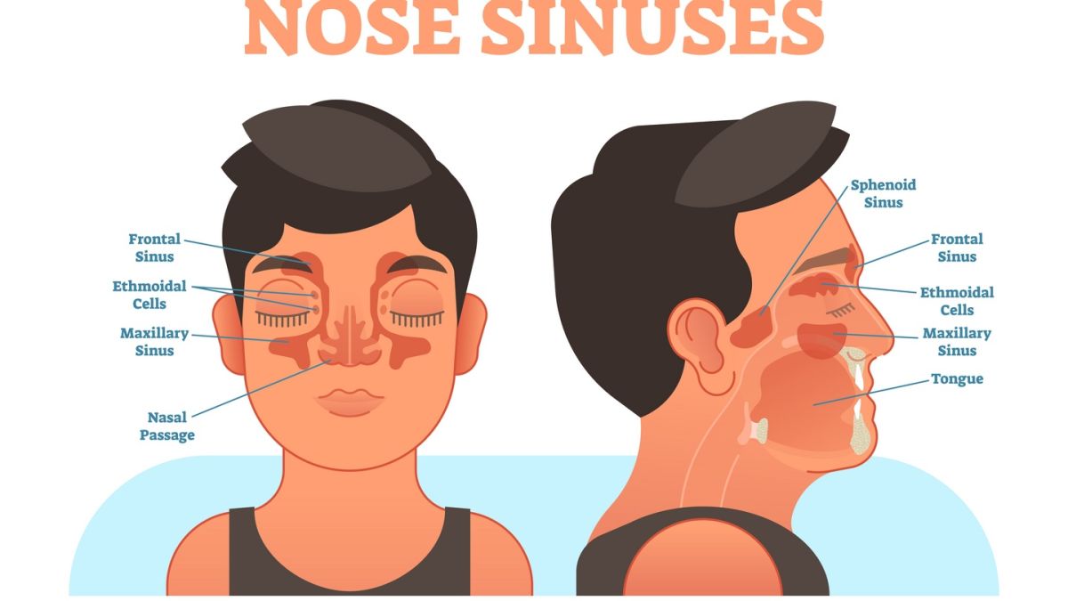 Beating Bad Sinuses The Magic Of Shooting Salt Water Up Your Nose