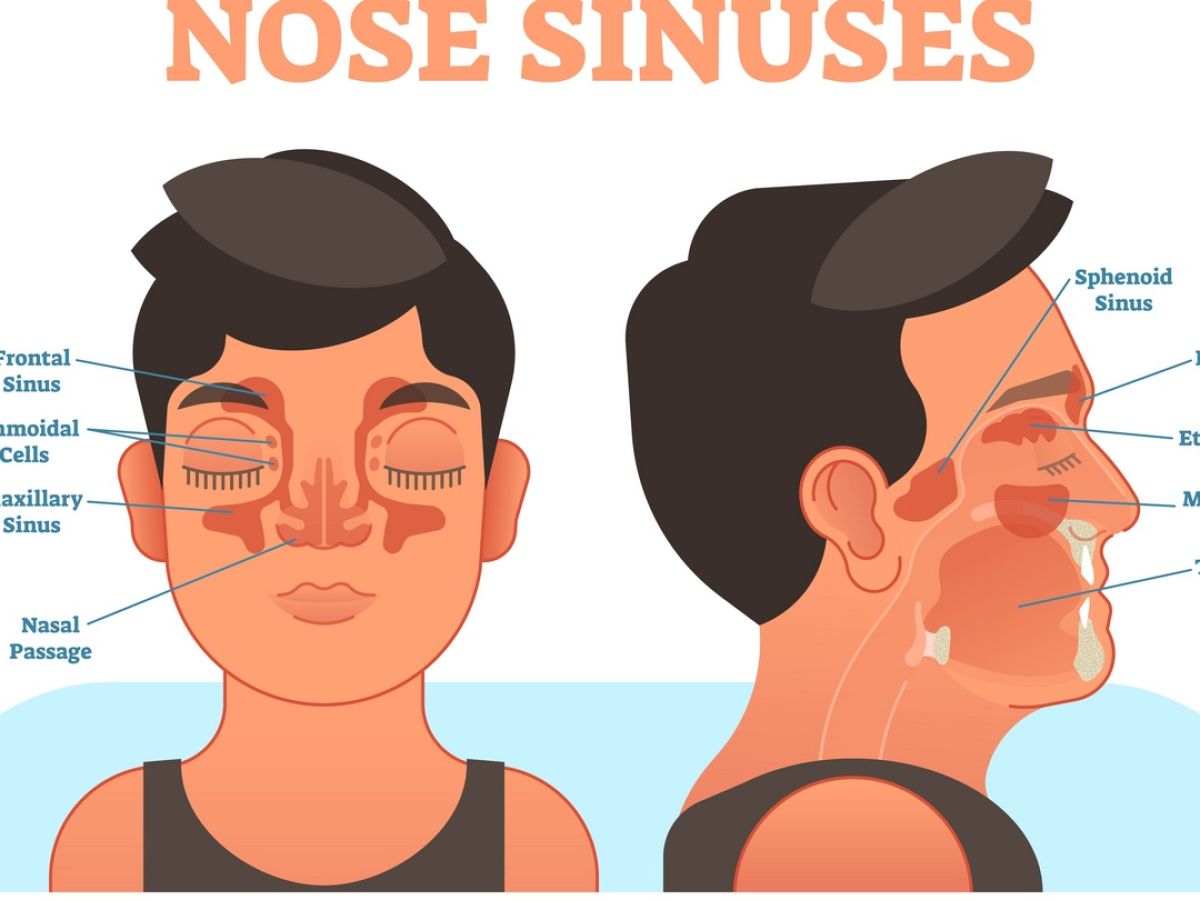 sinusitis nasal washing