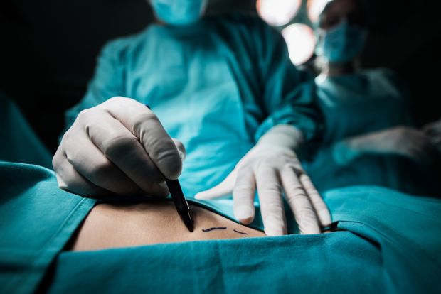 There are significant risks associated with cosmetic surgery and some recepients of a BBL have left unsatisfied and some have died as a result of complications from the procedure. Photograph: iStock