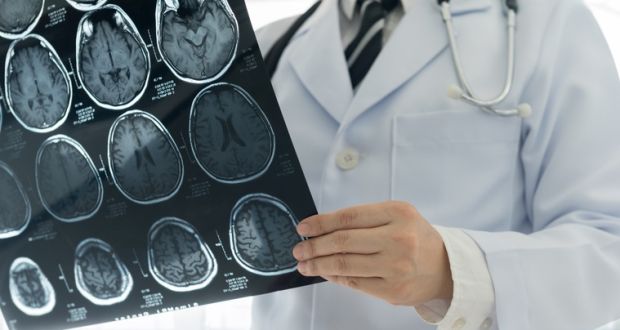 The Irish National Audit of Stroke 2020 report said there are about 6,000 strokes admitted to Irish hospitals a year. Photograph: iStock