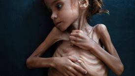 Yemen girl whose image drew attention to famine is dead