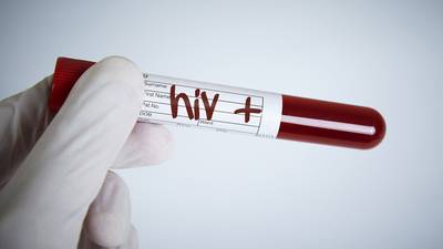 Number of HIV cases in Ireland up by 5% last year, HSE says