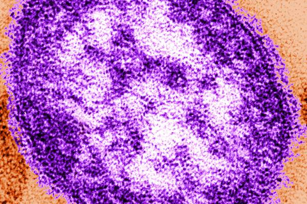HSE issues measles alert for Temple Street hospital visitors