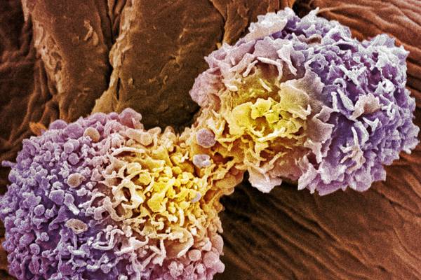 Israeli cancer treatment could be something special