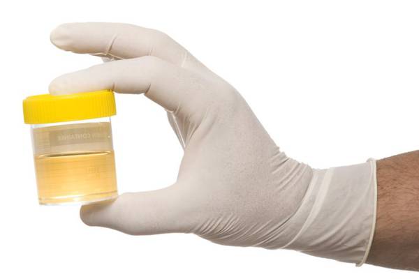 Drinking your own urine? There’s a Facebook group for that
