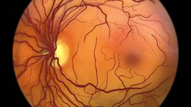 Gene editing opens door to new treatments for inherited retinal diseases