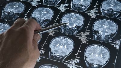 Spatial tests could reveal early sign of Alzheimer’s, says expert