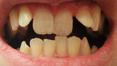 State Papers: Children’s teeth compared poorly with other countries
