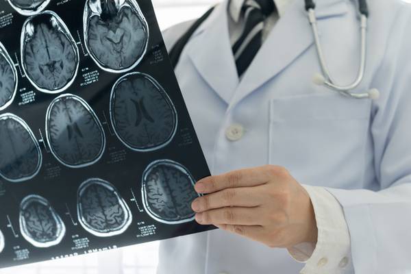 Admissions to stroke units 20% lower than target, audit finds