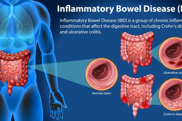 What breakthrough in inflammatory bowel disease was discovered this week?