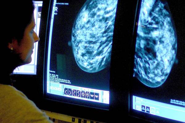 ‘Serious failure’ in Britain’s breast cancer screening programme