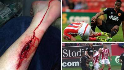 Tackle on Stephen Ireland by Maynor Figueroa condemned by Mark Hughes