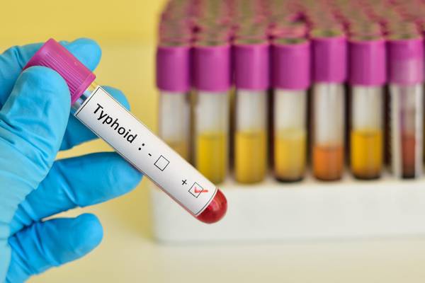 Typhoid makes an unwelcome return to Ireland, says HSE
