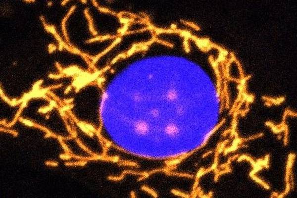 Irish scientists develop gene therapy for inherited vision loss disorder