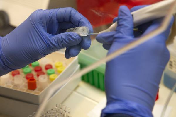 Coronavirus cases may be tens of times higher than previously thought, study says