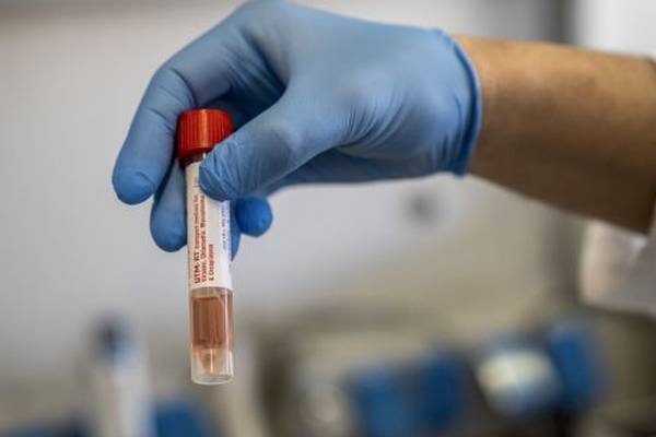 Coronavirus: NPHET concerns over reliability of antibody tests