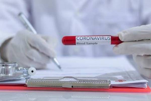 Covid-19 mass testing programme to be reviewed as disease comes under control