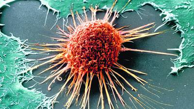 Review of cervical cancer slides now expected to be six months late