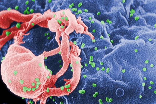Dr Muiris Houston: Talk of a ‘cure’ for HIV is premature