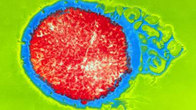 HSE concerned at upsurge in gonorrhoea cases