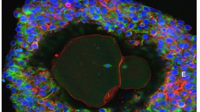 Human eggs fully grown in laboratory for the first time