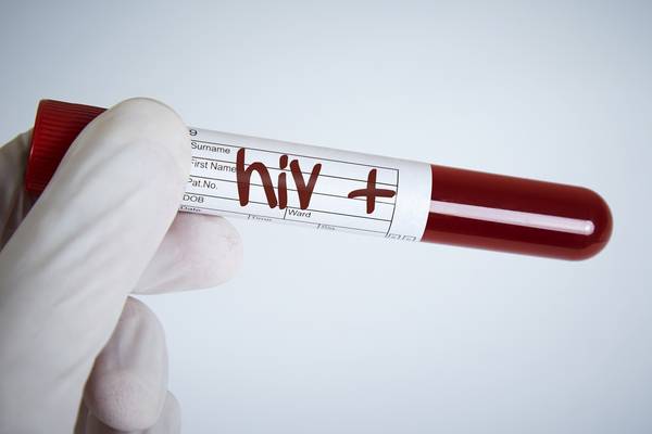 Number of HIV cases in Ireland up by 5% last year, HSE says