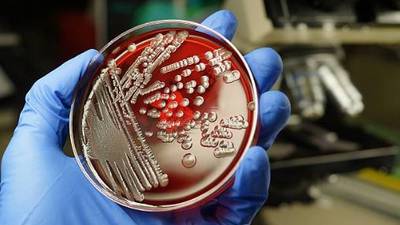 X-ray techniques used on E.coli in push for new antibiotics