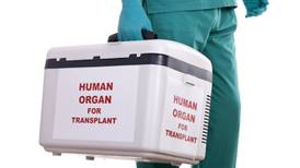 Will an opt-out register improve rates of organ donation?