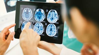 Committee rejects project to harvest brain tumour data