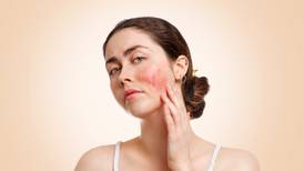 Rosacea: What is it and how can you manage it?