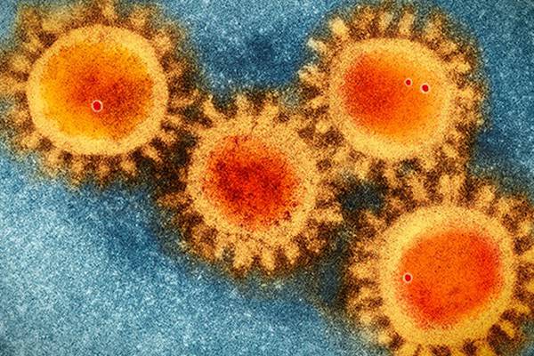 Coronavirus: 310 more cases as school detections rise by 60%