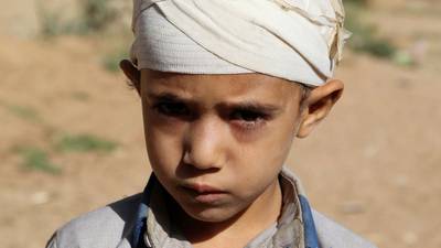 The Irish Times view on the war in Yemen: A country at risk of starvation