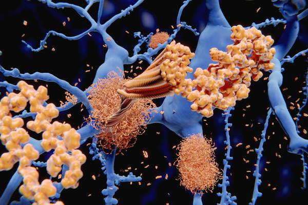 European regulators cast doubt on Biogen Alzheimer’s treatment