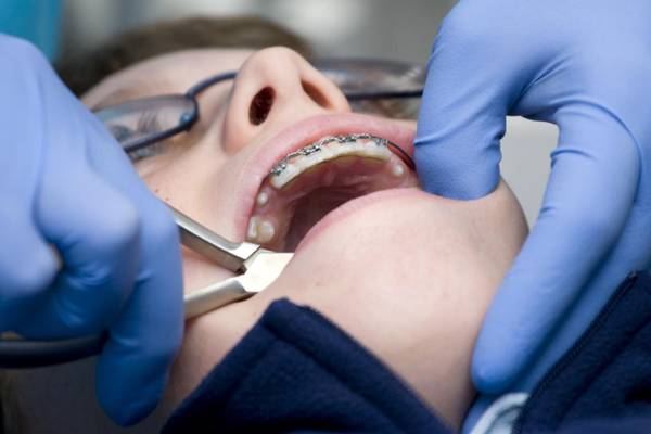 HSE refuses to publish report on flawed orthodontic treatment