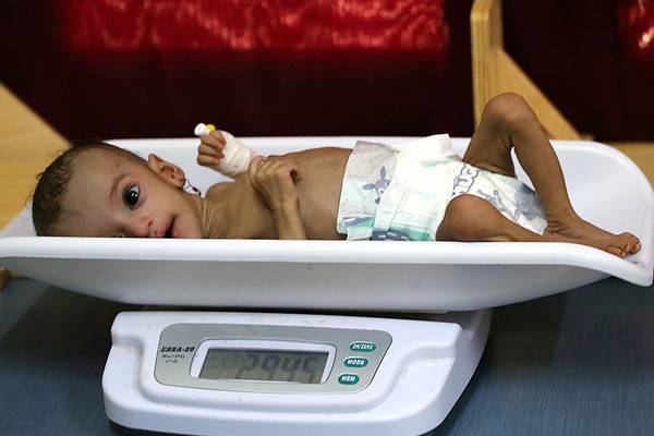 Starvation ‘death sentence’ looms for eight million people in Yemen