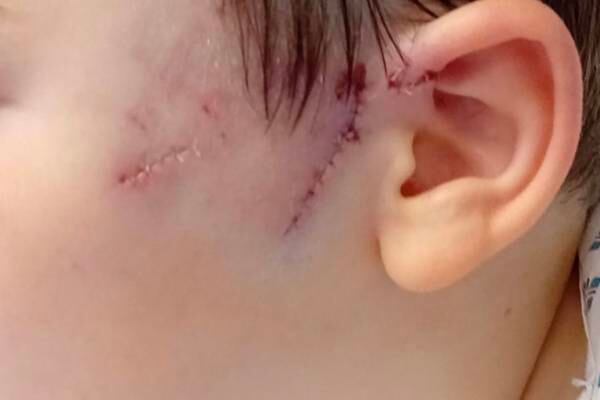 ‘The dog tore the face off him’: Boy savaged by dog in Limerick park 