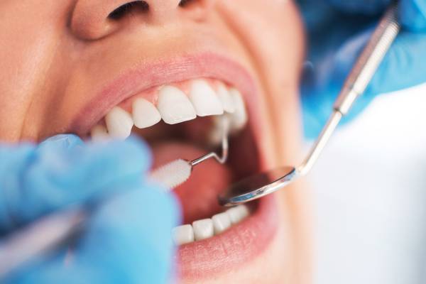 Expanded dental care services for medical card holders announced