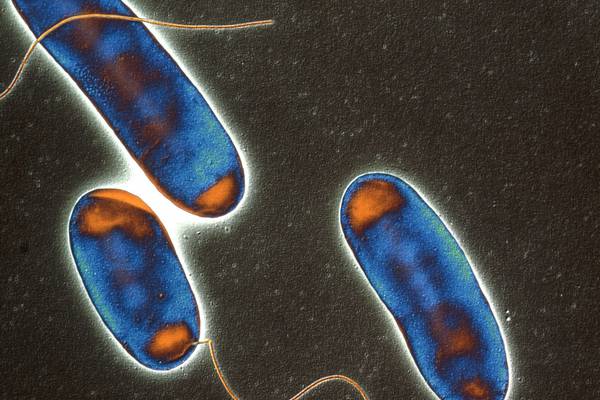 Legionella bacteria found in Dublin city offices