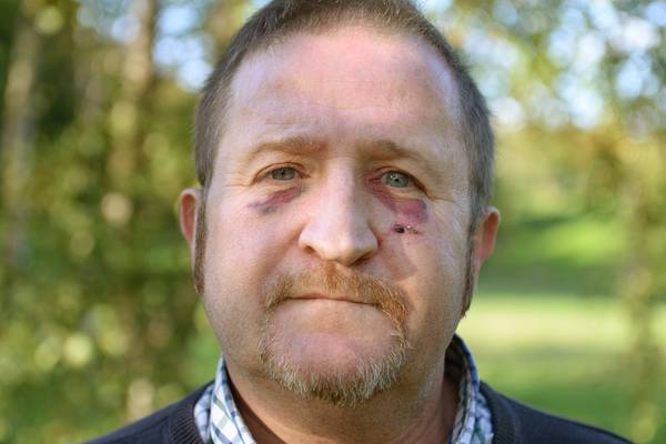Man badly beaten in suspected homophobic attack by Dublin youths