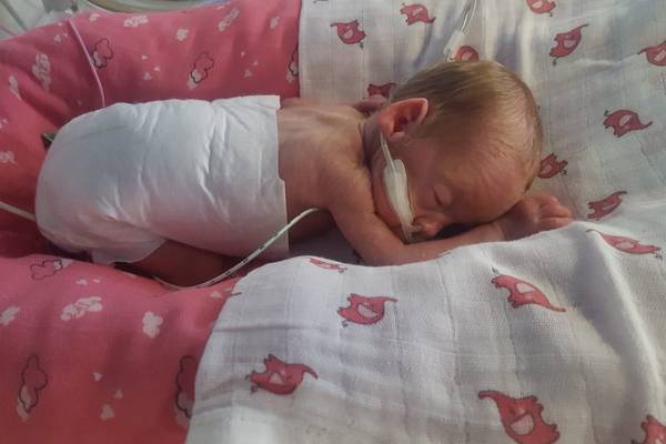 Born at 23 weeks: ‘What saved Sara was that she was over 500g’