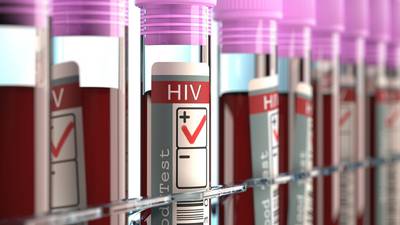 Younger people with HIV can live as long as those without it