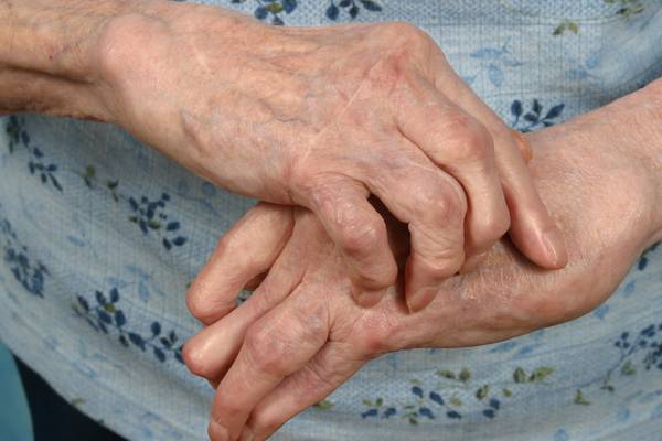 Arthritis drugs ‘could halve risk of patients developing dementia’