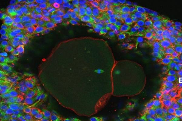 Human eggs fully grown in laboratory for the first time