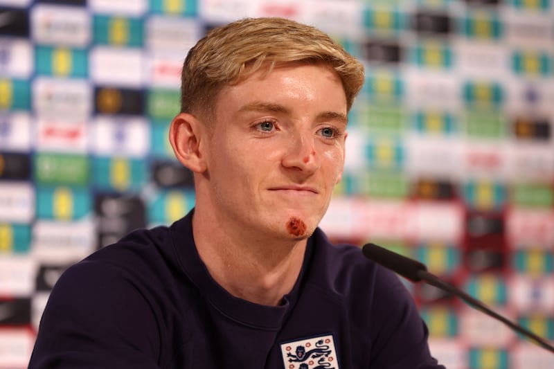 Anthony Gordon of England speaks to the media. Photograph: Richard Pelham/Getty